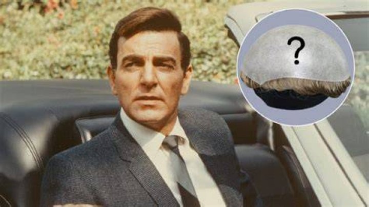 Did mannix wear a toupee