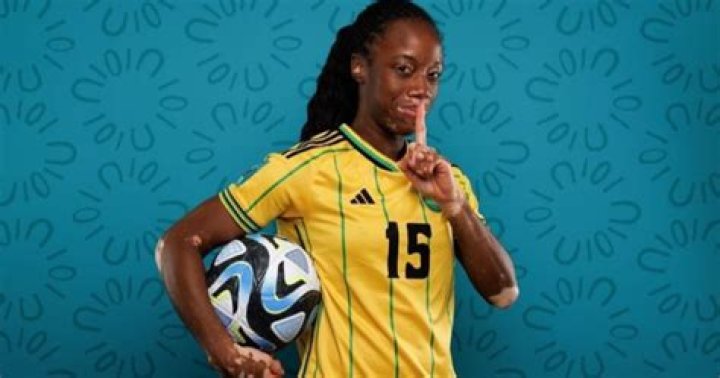 Is Tiffany Cameron with vitiligo?