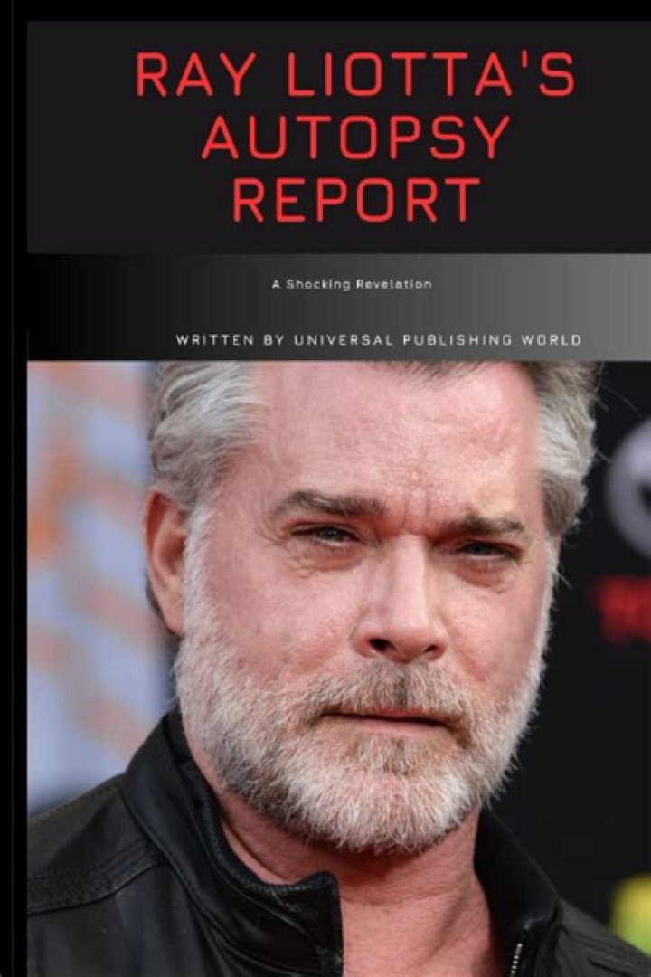 Ray Liotta autopsy report